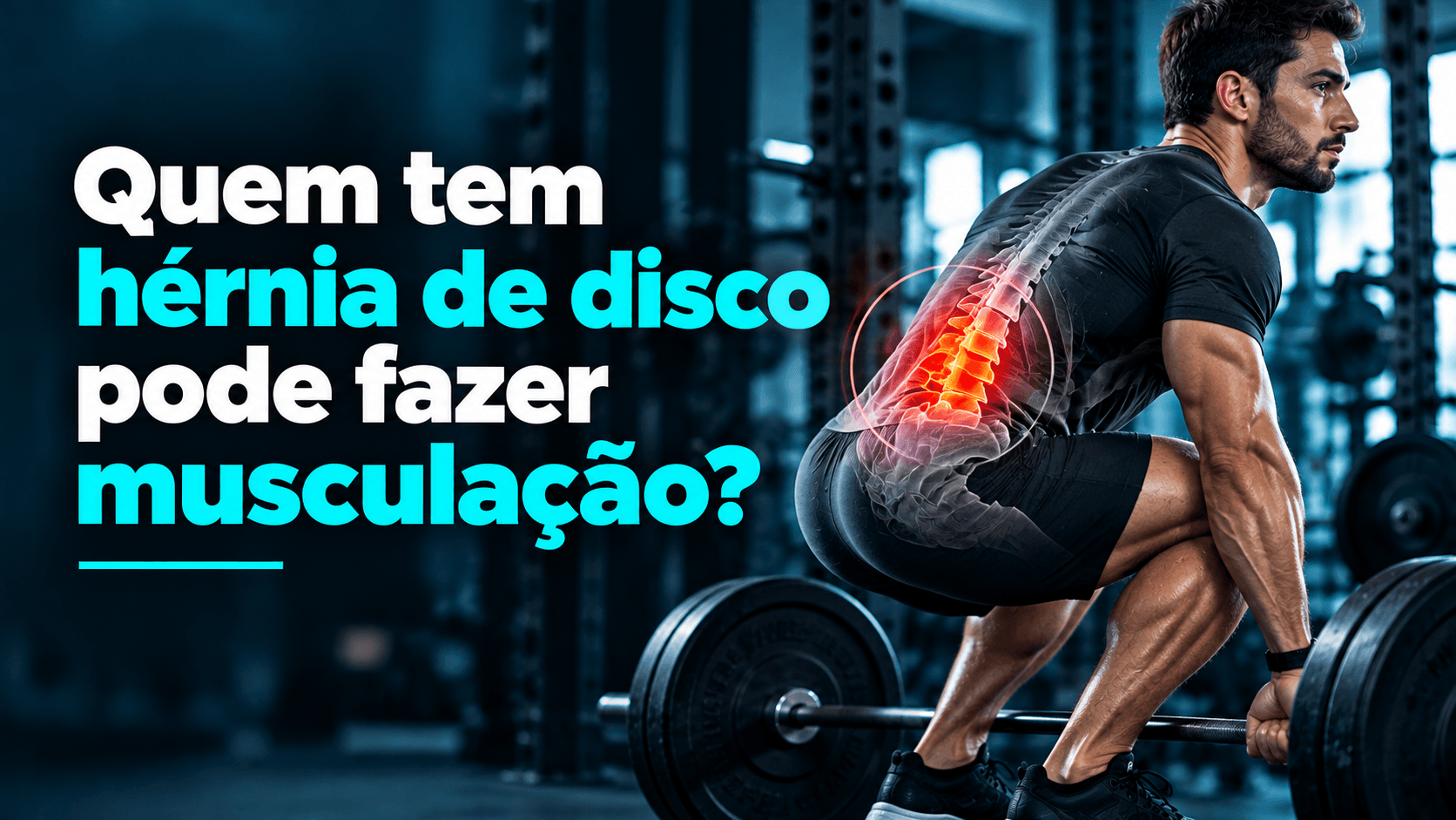 Quem tem hérnia de disco pode fazer musculação