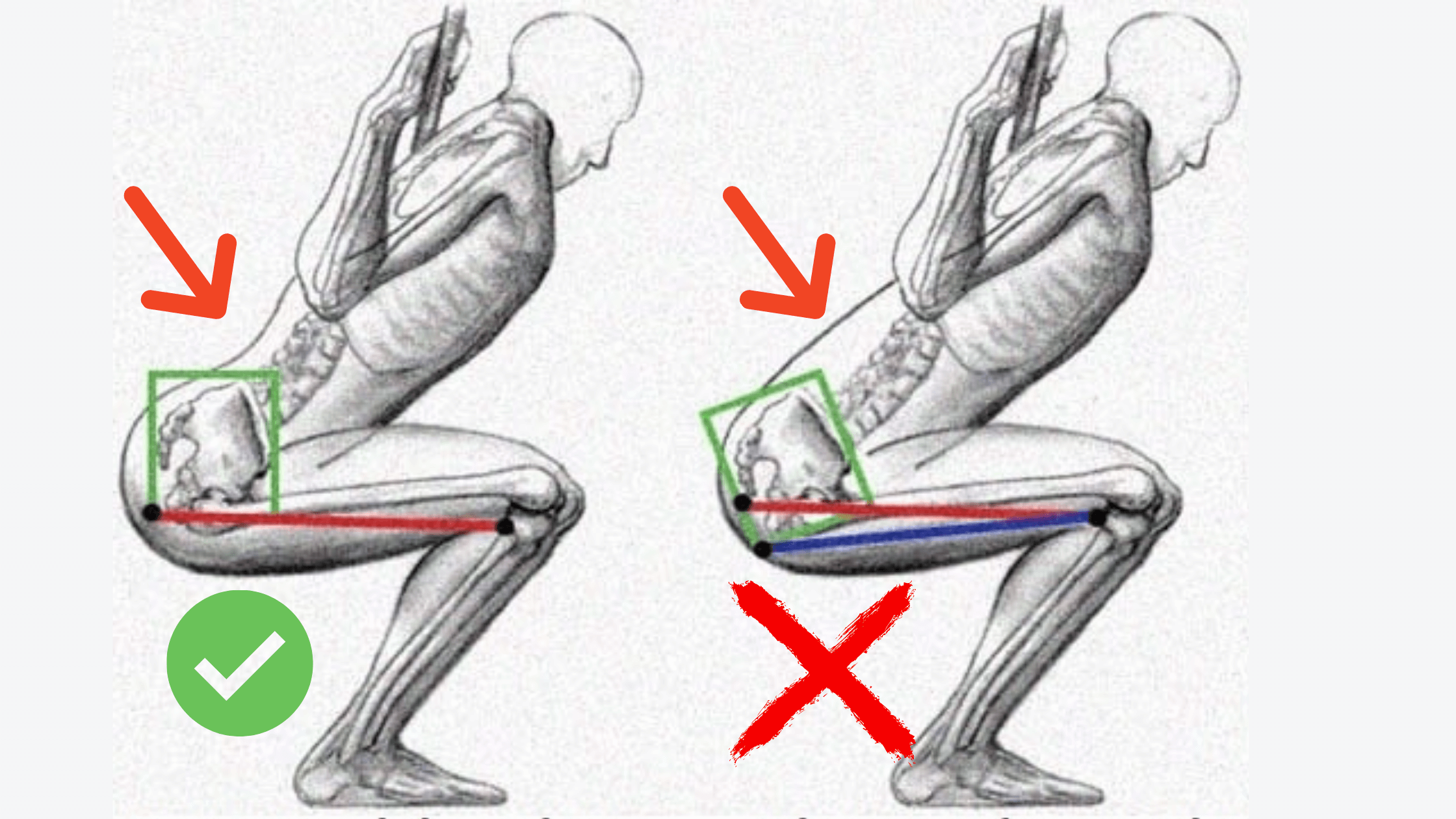 Agachamento sumô com halter - Como fazer e erros comuns